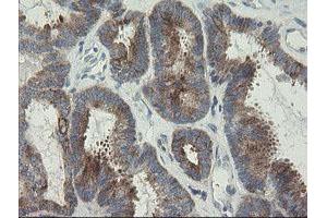 Image no. 3 for anti-RIO Kinase 2 (RIOK2) (AA 277-552) antibody (ABIN1491304)