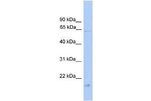 WB Suggested Anti-GK Antibody Titration: 0.