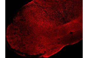 Indirect immunolabeling of PFA fixed mouse spinal cord vibratome sections (dilution 1 : 200). (Alpha, beta Synuclein 抗体)