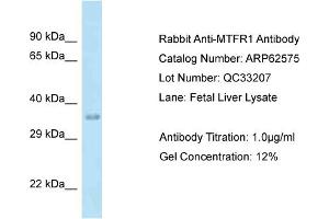 Western Blotting (WB) image for anti-Mitochondrial Fission Regulator 1 (MTFR1) (C-Term) antibody (ABIN971200) (MTFR1 抗体  (C-Term))