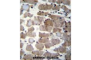 Formalin fixed and paraffin embedded human skeletal muscle stained with CTSK Antibody (Center) followed by peroxidase conjugation of the secondary antibody and DAB staining. (Cathepsin K 抗体  (Middle Region))
