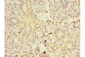 Immunohistochemistry of paraffin-embedded human pancreatic tissue using ABIN7153583 at dilution of 1:100 (GDAP1L1 抗体  (AA 101-260))