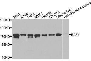 Western blot analysis of extracts of various cell lines, using RAF1 antibody (ABIN5970053) at 1/1000 dilution. (RAF1 抗体  (C-Term))