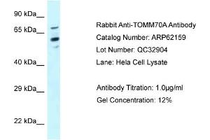 Western Blotting (WB) image for anti-Translocase of Outer Mitochondrial Membrane 70 (TOMM70A) (N-Term) antibody (ABIN786547) (TOM70 抗体  (N-Term))