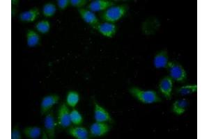 Detection of CYCS in Human MCF7 Cells using Monoclonal Antibody to Cytochrome C (CYCS)