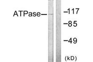 Western blot analysis of extracts from 293 cells, treated with PMA 125ng/ml 30', using ATPase (Ab-16) Antibody.