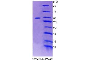 SDS-PAGE analysis of Human PTPN3 Protein. (PTPN3 蛋白)