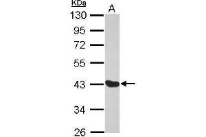 WB Image Sample (30 ug of whole cell lysate) A: MCF-7 10% SDS PAGE antibody diluted at 1:1000