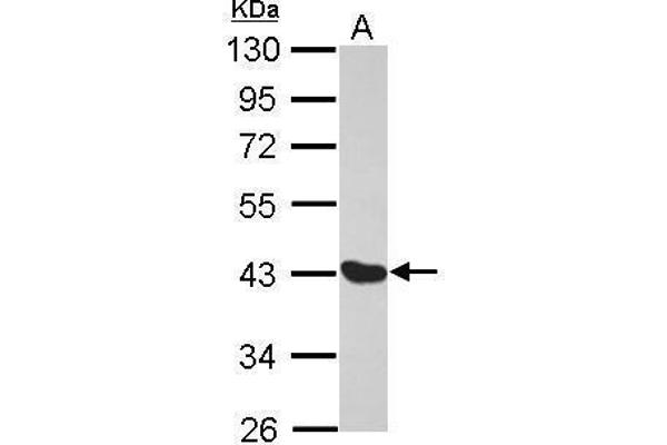 Melanoma Antigen Family D, 4 (MAGED4) (Center) antibody