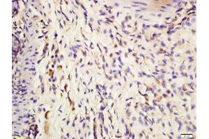 Formalin-fixed and paraffin embedded mouse intestine labeled with Anti-IL-3 Polyclonal Antibody, Unconjugated  at 1:200 followed by conjugation to the secondary antibody and DAB staining. (IL-3 抗体  (AA 101-166))