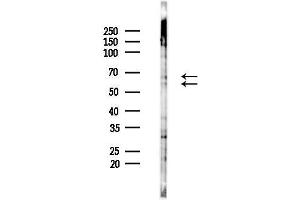 anti-Carcinoembryonic Antigen-Related Cell Adhesion Molecule 6 (CEACAM6) (Internal Region) antibody