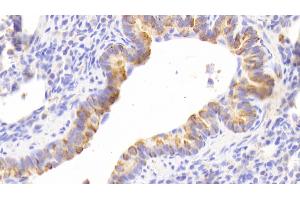 Detection of CK13 in Human Lung Tissue using Polyclonal Antibody to Cytokeratin 13 (CK13) (Cytokeratin 13 抗体  (AA 104-403))
