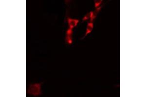 ABIN6278483 staining 293 by IF/ICC. (IL4 Receptor 抗体  (N-Term))