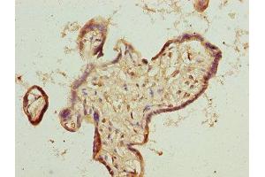 Immunohistochemistry of paraffin-embedded human placenta tissue using ABIN7173261 at dilution of 1:100 (TMEM65 抗体  (AA 63-240))