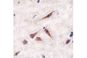 Image no. 1 for anti-ES cell expressed Ras (ERAS) (N-Term) antibody (ABIN356980) (ERAS 抗体  (N-Term))