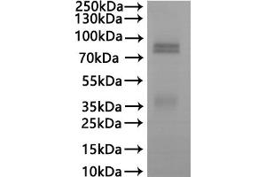 ABIN7937639, ABIN8118134 and ABIN8118135 is detected by Mouse anti-6*His monoclonal antibody.