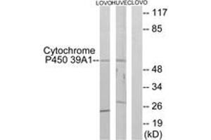 Western blot analysis of extracts from LOVO/HuvEc cells, using Cytochrome P450 39A1 Antibody.