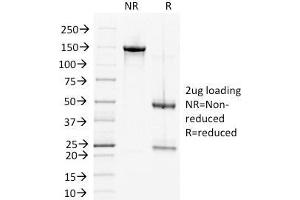 SDS-PAGE Analysis Purified DSG2 Mouse Monoclonal Antibody (6D8).