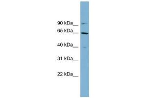 WB Suggested Anti-KRT84 Antibody Titration: 0. (Keratin 84 抗体  (Middle Region))