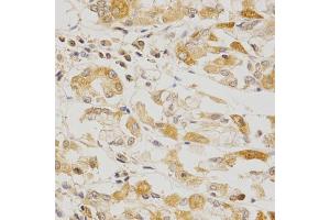 Immunohistochemistry of paraffin-embedded human stomach using OLR1 Antibody (ABIN5970808) at dilution of 1/200 (40x lens). (OLR1 抗体)