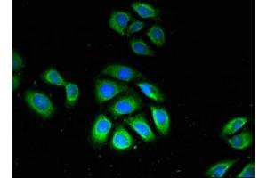 Immunofluorescent analysis of A549 cells using ABIN7163349 at dilution of 1:100 and Alexa Fluor 488-congugated AffiniPure Goat Anti-Rabbit IgG(H+L) (GPX4 抗体  (AA 74-197))