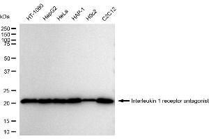 Western blotting analysis using Interleukin 1 receptor antagonist antibody (ABIN7799094).