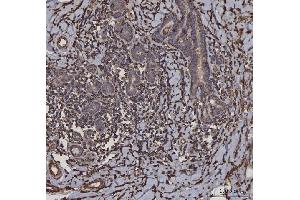 anti-HLA Class II DR alpha (HLA-DRA) (AA 26-254) antibody