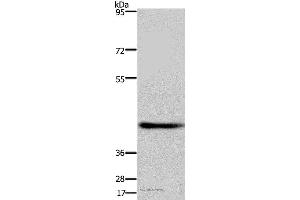 Western blot analysis of Human fetal brain tissue, using DRG1 Polyclonal Antibody at dilution of 1:500 (DRG1 抗体)