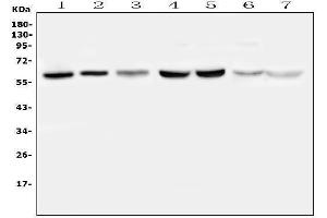 Western blot analysis of PLAT using anti-PLAT antibody (ABIN6719378).