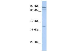 Tenomodulin antibody used at 1 ug/ml to detect target protein. (TNMD 抗体  (Middle Region))