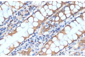 Immunohistochemistry of paraffin-embedded Human colon using HHLA2 Polyclonal Antibody at dilution of 1:100 (40x lens). (HHLA2 抗体)