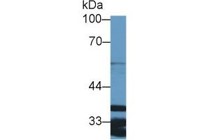 Western Blotting (WB) image for anti-Actin Related Protein 2/3 Complex, Subunit 2, 34kDa (ARPC2) (AA 1-300) antibody (ABIN7441580)