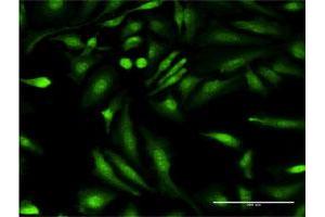 Immunofluorescence of monoclonal antibody to HGD on HeLa cell. (HGD 抗体  (AA 377-445))