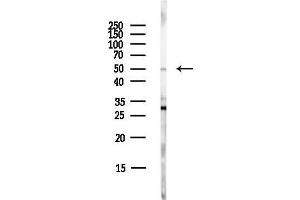 Western blot analysis of lysates from EC304 cells(LPS,4h treatment), using WASH1 Antibody at 1/1000 dilution. (WAS Protein Family Homolog 1 (WASH1) 抗体)
