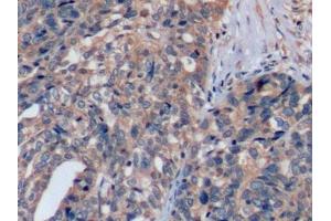 Immunohistochemistry (IHC) image for anti-Mast/stem Cell Growth Factor Receptor (KIT) (AA 321-520) antibody (ABIN7431107)