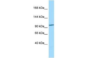 Host: Rabbit Target Name: CCDC66 Sample Type: 293T Whole Cell lysates Antibody Dilution: 1. (CCDC66 抗体  (N-Term))