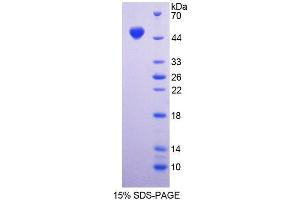 SDS-PAGE analysis of Mouse DAG1 Protein. (Dystroglycan 蛋白)