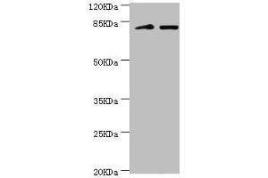 Western blot All lanes: KIF2B antibody at 3. (KIF2B 抗体  (AA 544-673))