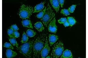 IF analysis of PAK3 using anti-PAK3 antibody (ABIN7599182).
