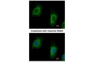 ICC/IF Image Immunofluorescence analysis of paraformaldehyde-fixed HeLa, using TTC1, antibody at 1:500 dilution. (TTC1 抗体)