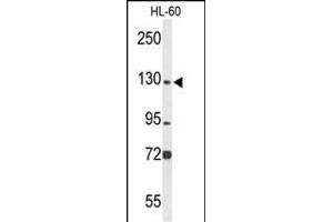 Western blot analysis of MCM2 Antibody (C-term) (ABIN653324 and ABIN2842815) in HL-60 cell line lysates (35 μg/lane). (MCM2 抗体  (C-Term))