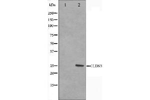 Western blot analysis on A549 cell lysate using Claudin 5 Antibody,The lane on the left is treated with the antigen-specific peptide. (Claudin 5 抗体  (C-Term))