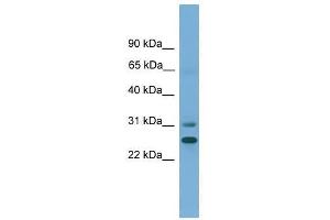 Western Blot showing DHRS2 antibody used at a concentration of 1-2 ug/ml to detect its target protein. (DHRS2 抗体  (N-Term))