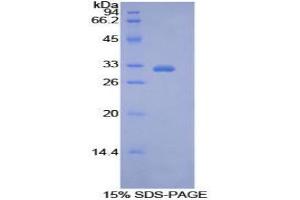 SDS-PAGE analysis of Human PDK4 Protein. (PDK4 蛋白)