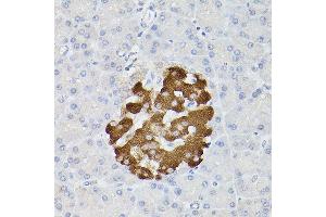 Immunohistochemistry of paraffin-embedded rat pancreatic islet using Insulin Rabbit pAb (ABIN3022884, ABIN3022885, ABIN3022886 and ABIN6219279) at dilution of 1:100 (40x lens). (Insulin 抗体  (AA 1-110))