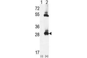 Western blot analysis of TPK1 (arrow) using rabbit polyclonal TPK1 Antibody (N-term) . (TPK1 抗体  (N-Term))