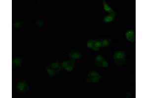 Immunofluorescence staining of HepG2 cells with ABIN7139715 at 1:50, counter-stained with DAPI. (alpha 1 Adrenergic Receptor 抗体  (AA 6-22))
