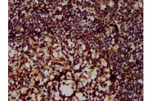 IHC image of ABIN6999591 diluted at 1:300 and staining in paraffin-embedded human tonsil tissue performed on a Leica BondTM system. (MX2 抗体  (AA 548-688))