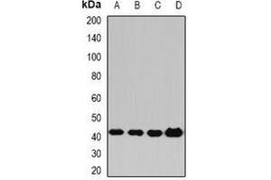 Western blot analysis of PP2C-alpha expression in Hela (A), HepG2 (B), mouse liver (C), rat brain (D) whole cell lysates. (PPM1A 抗体)