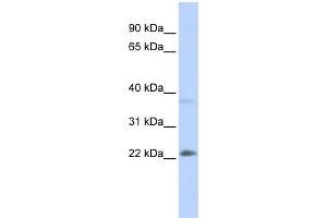 WB Suggested Anti-SRY Antibody Titration:  0. (SRY 抗体  (Middle Region))